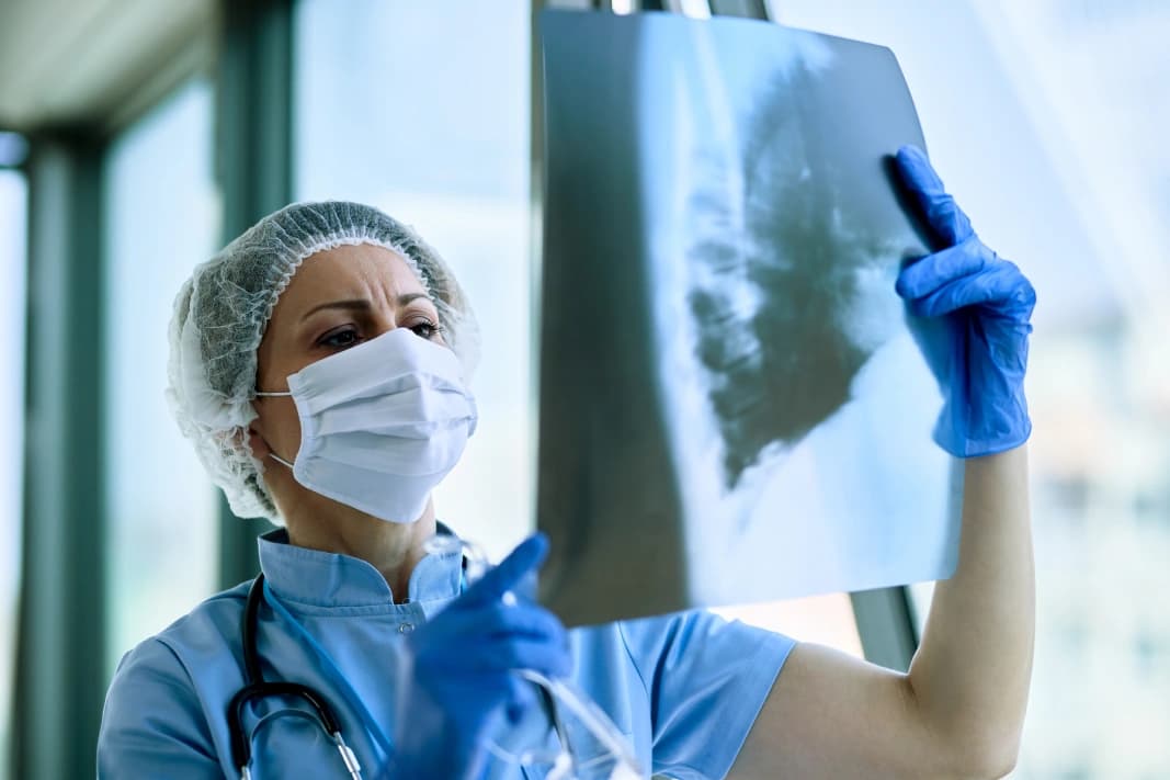 Clinician in a mask and gloves reviewing a chest X-ray